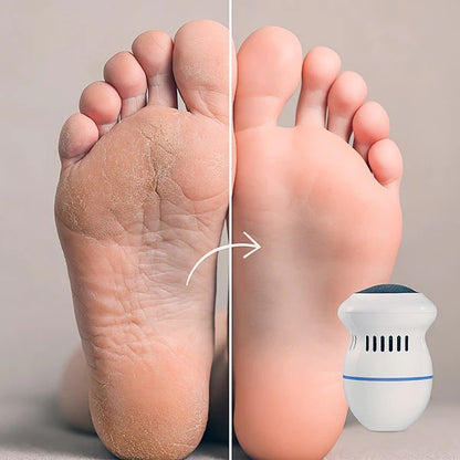 Pulidor de callos TENDENCIA 😍