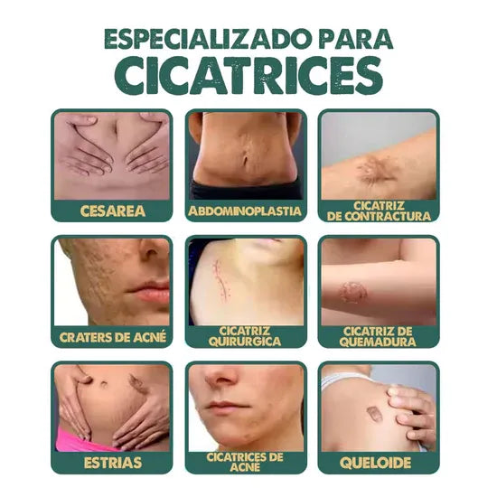 Eliminador de cicatrices VIRAL 🤩