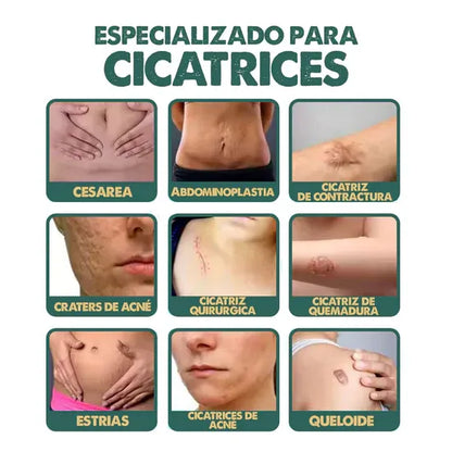 Eliminador de cicatrices VIRAL 🤩